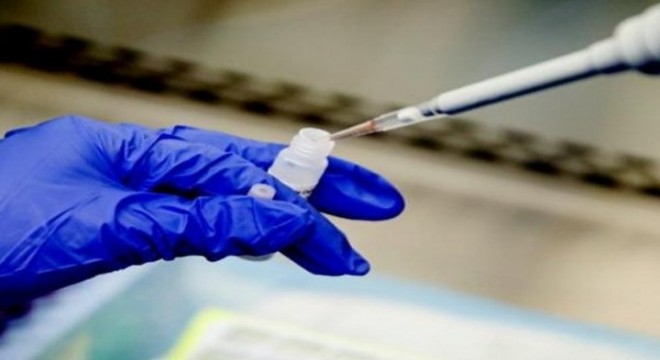 Çin Askeri Bilimler Akademisi ilk koronavirüs aşısının patentini aldı