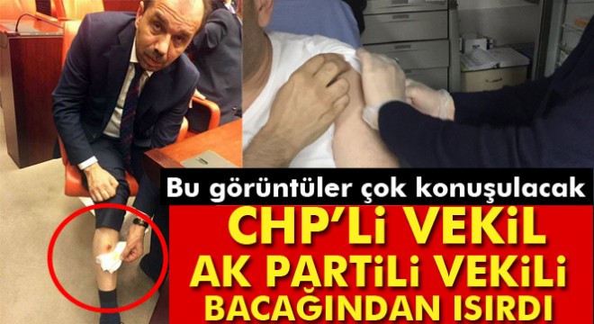 TBMM de CHP Milletvekili, AK Partili Balta yı bacağından ısırdı