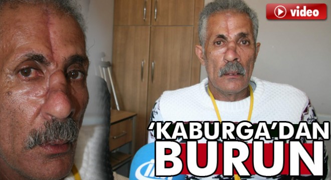 Burnu kırılmıştı; Yemen’in kokusunu Türkiye’de aldı